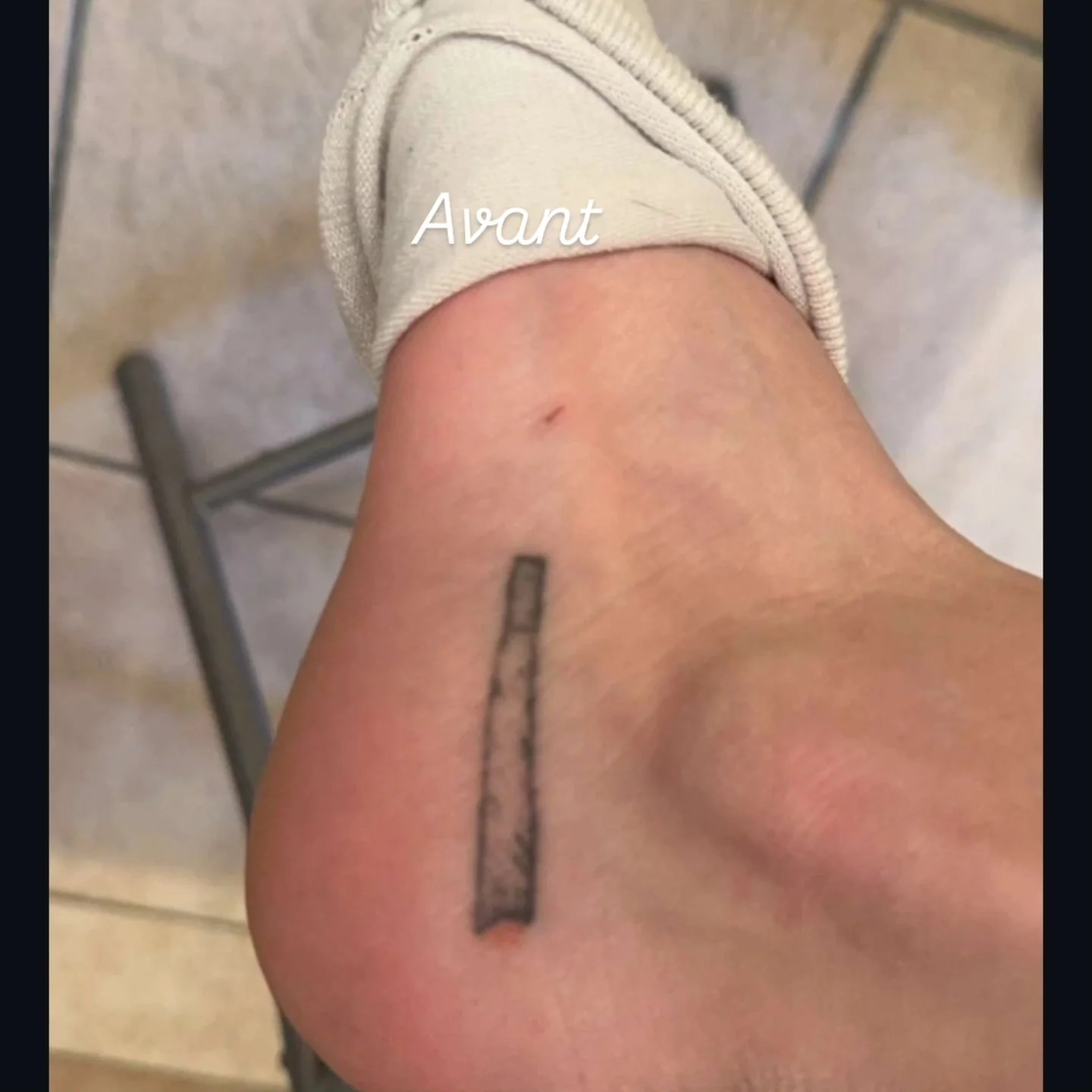 Avant cover-up : ancien tatouage rectangulaire noir sur la cheville et le pied